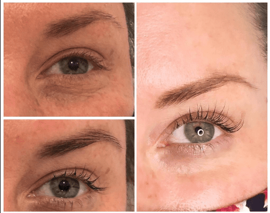Grande Lash MD before and after