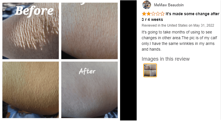 Gold Bond Crepe Corrector before and after