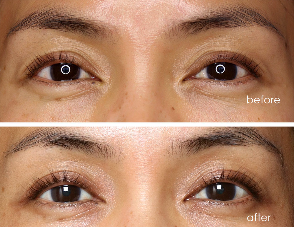 Rodan and Fields Lash Boost serum before and after