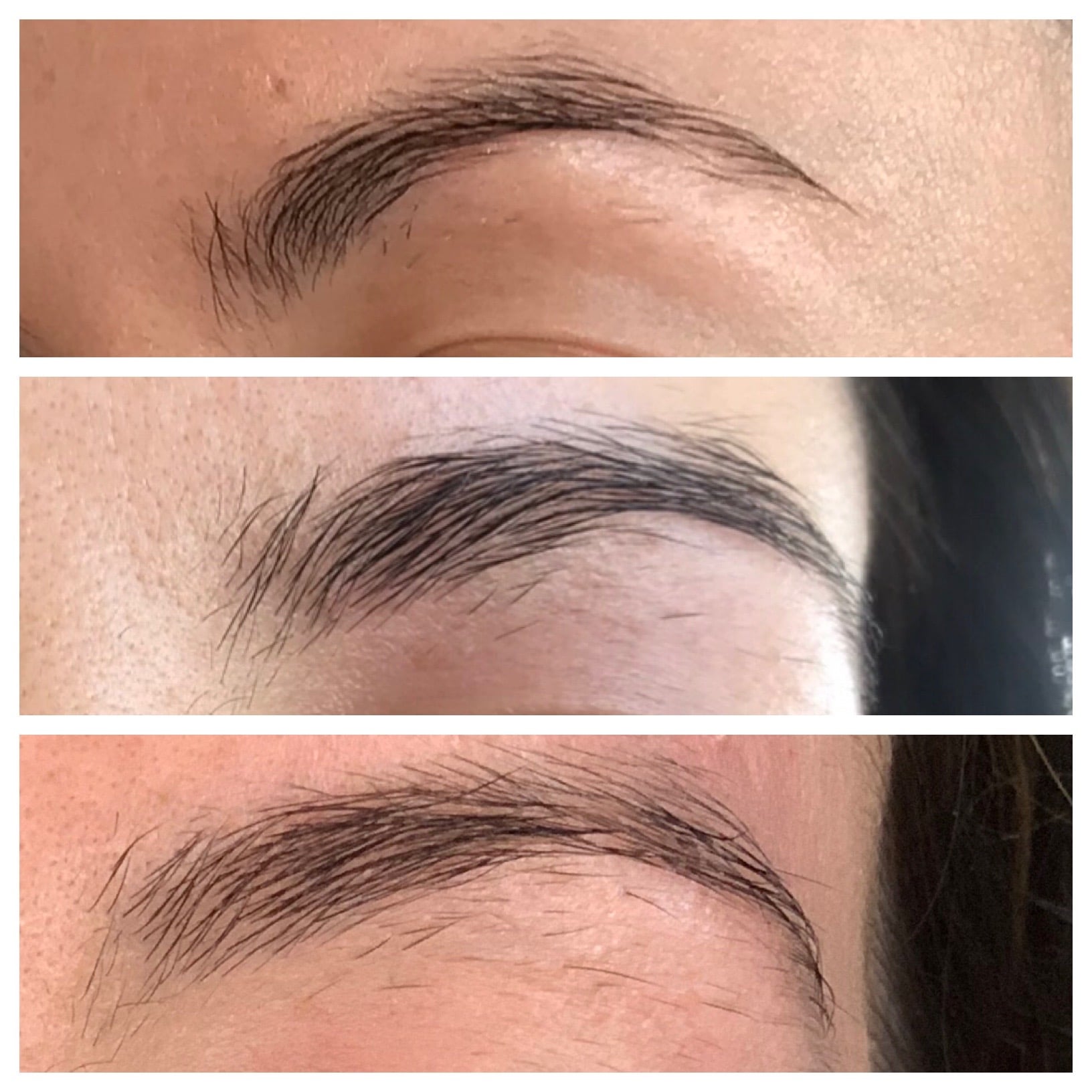 Neubrow before and after