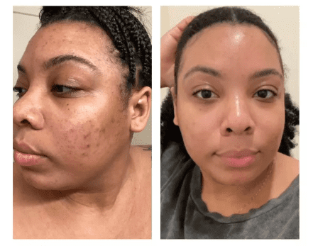 Rosen Skincare Reviews