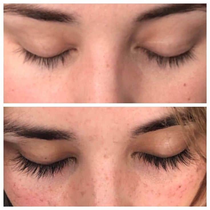 Latisse VS Lash Boost