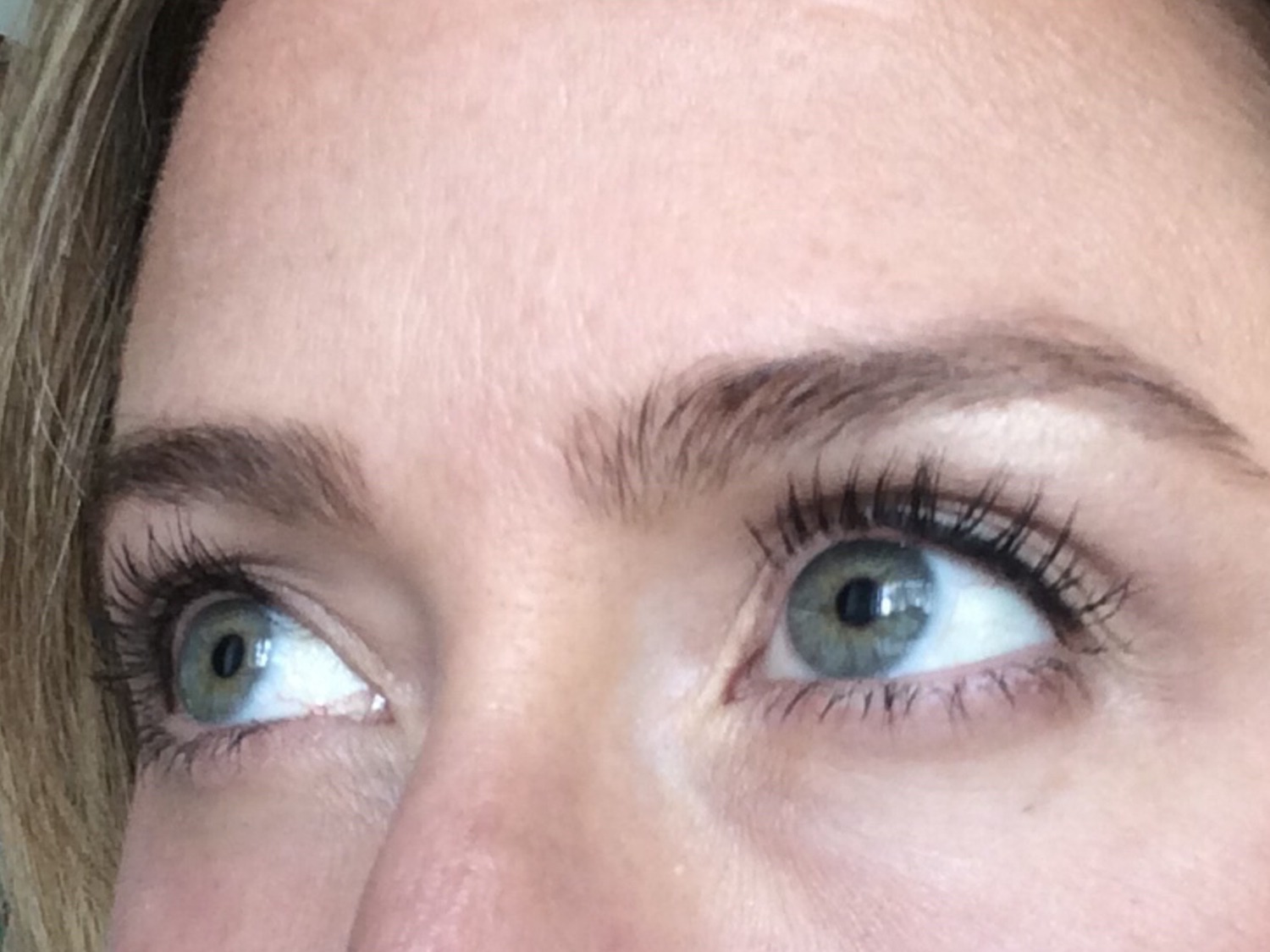 Latisse VS Lash Boost