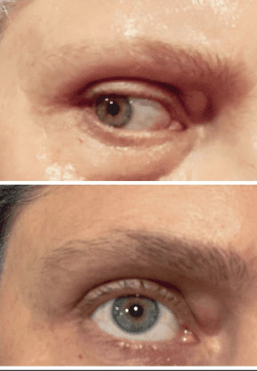 GrandeBrow Before And After