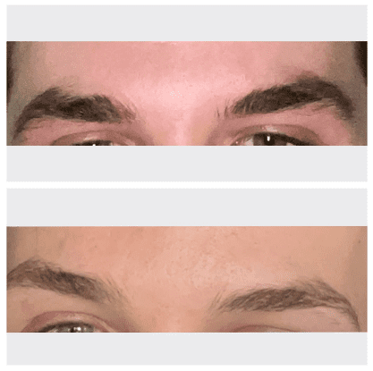 GrandeBrow Before And After