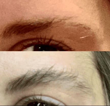 Nourishbrow Reviews | Keeps Everyone’s Gaze Fixed On Your Brows ...