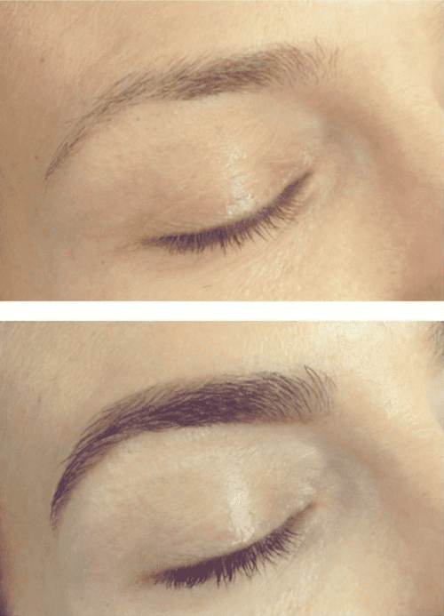 Nourishbrow before and after 