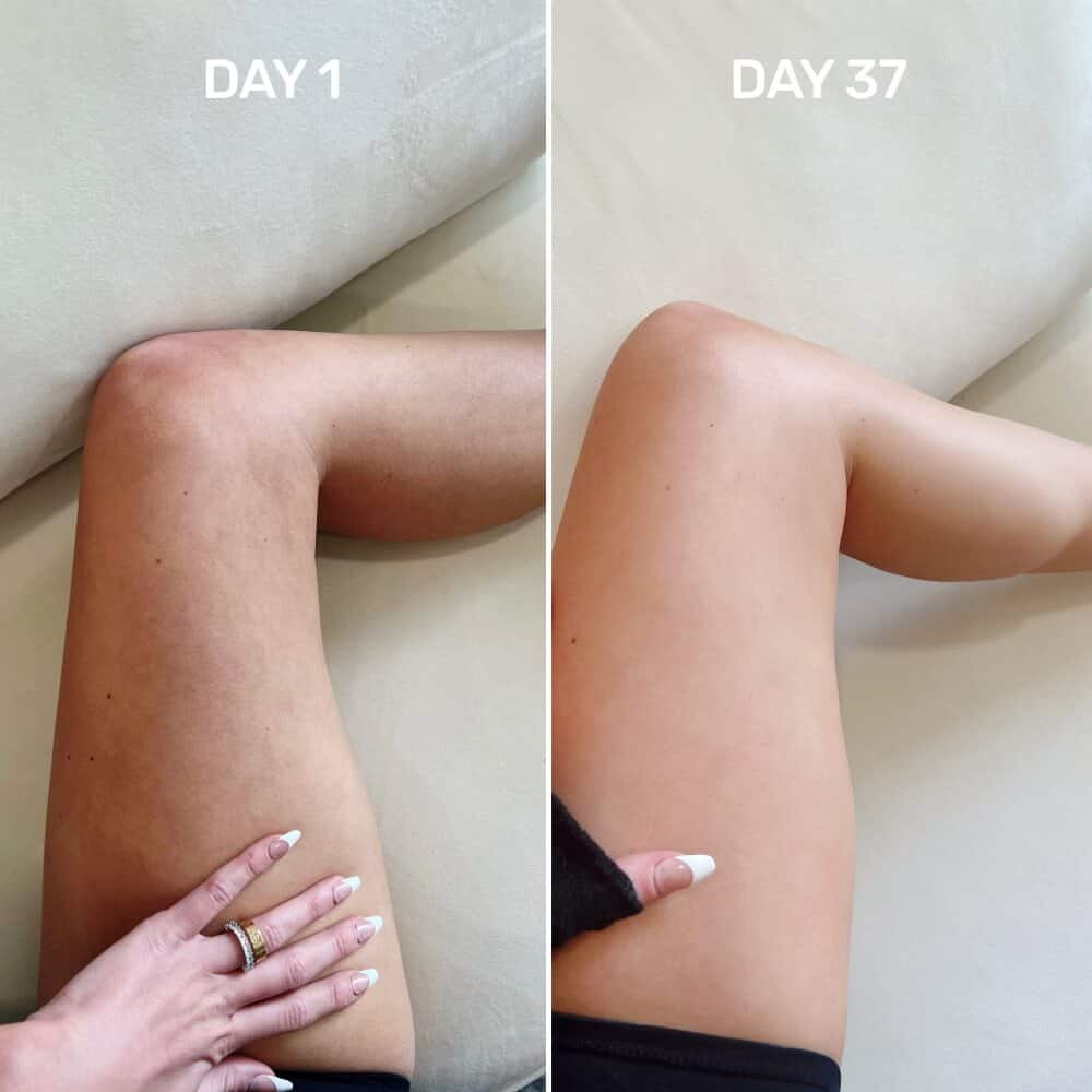 B-Foxy Inner Thigh Firming Cream before and after