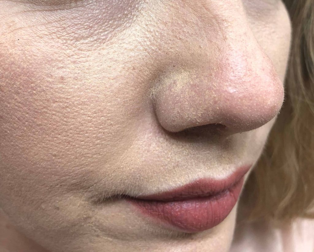 Why Does My Makeup Look Patchy? (Quick Fix) Blushastic