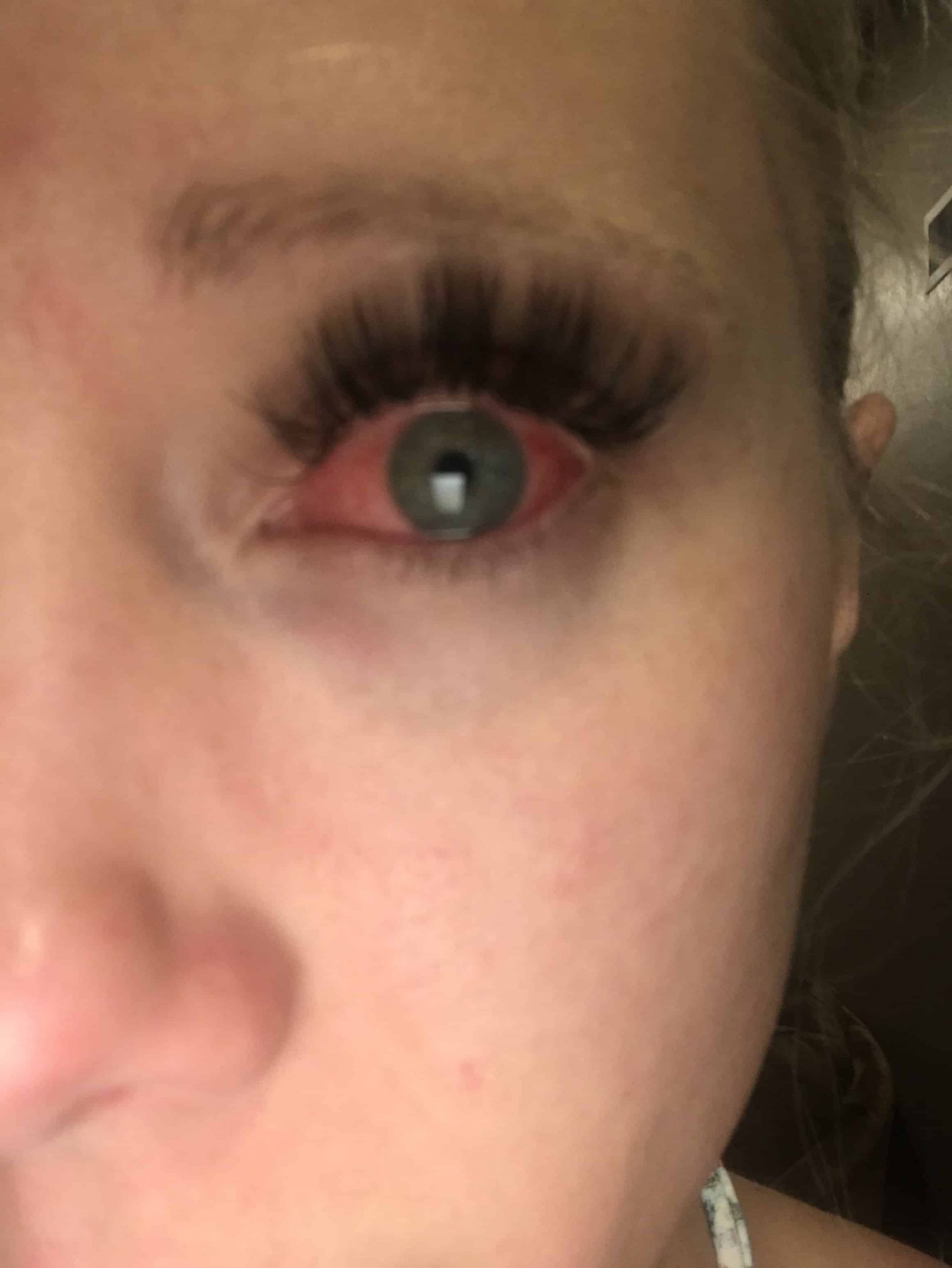 Red Eyes After Eyelash Extensions Causes & Prevention Blushastic