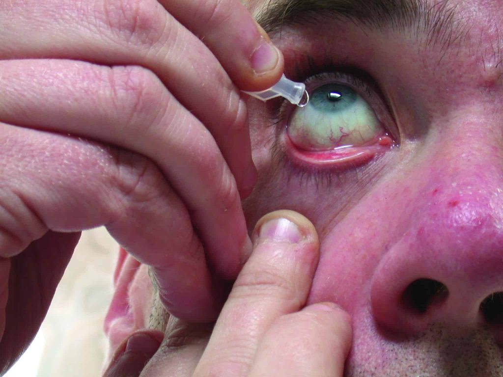 Ocular adverse effects