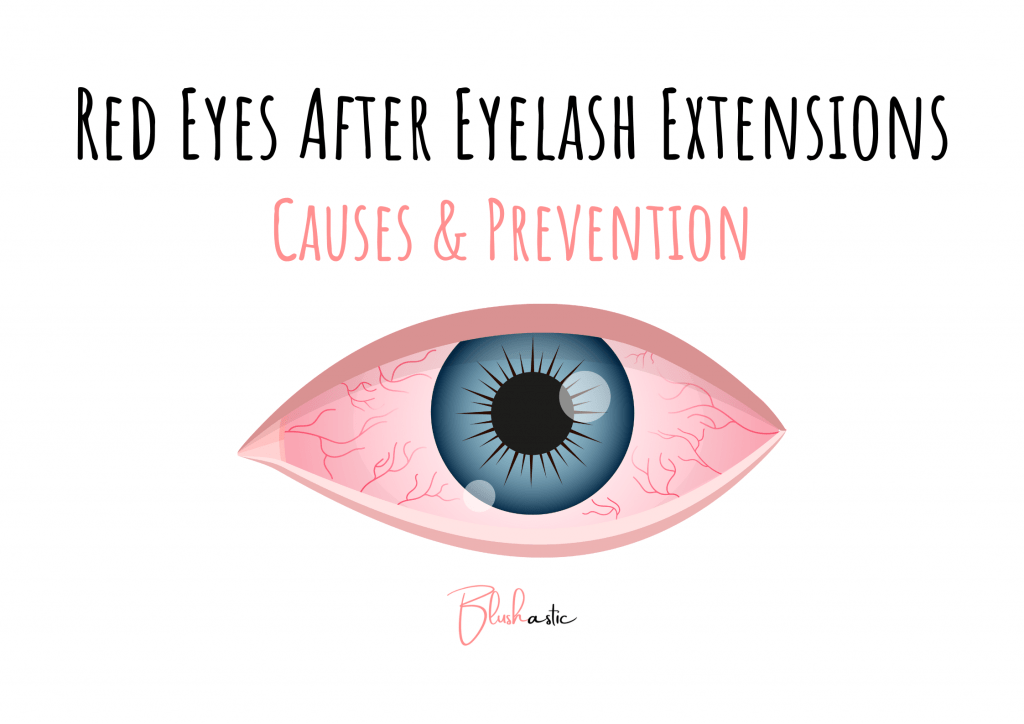 Red Eyes After Eyelash Extensions