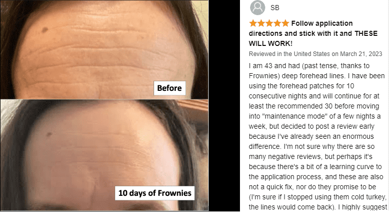 frownies before and after