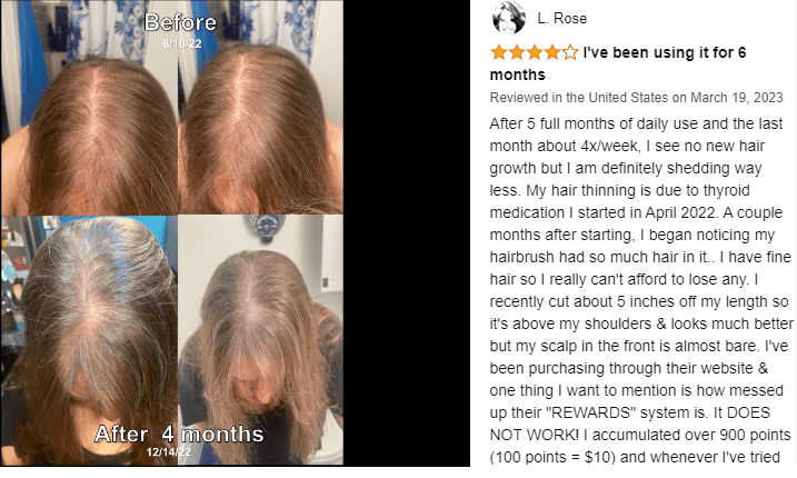Vegamour Hair Serum customer review