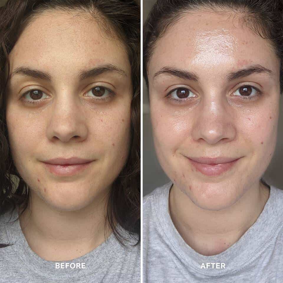 exfoliators before and after 