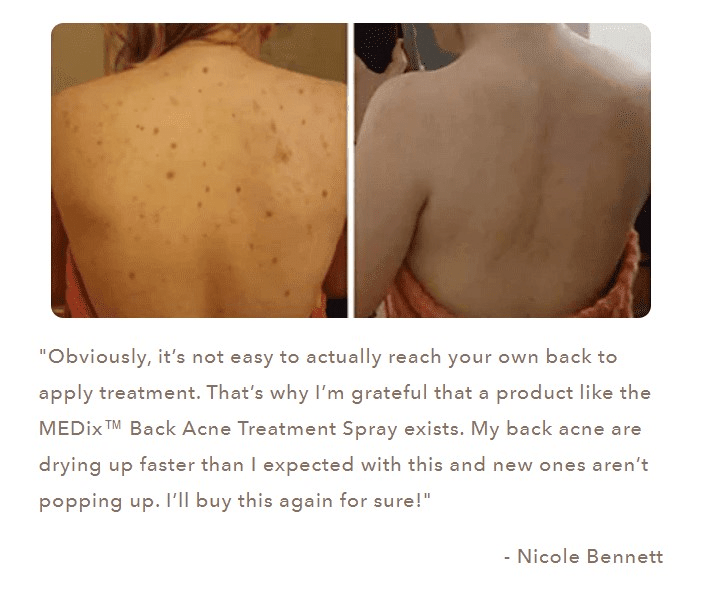 Herbaluxy Back Acne Reviews 