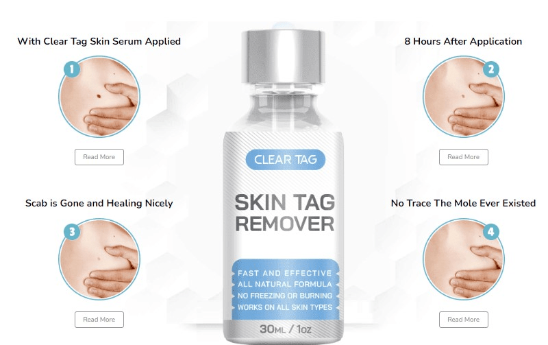 clear tag skin tag remover benefits 