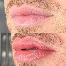 What is Lip Blushing side effects