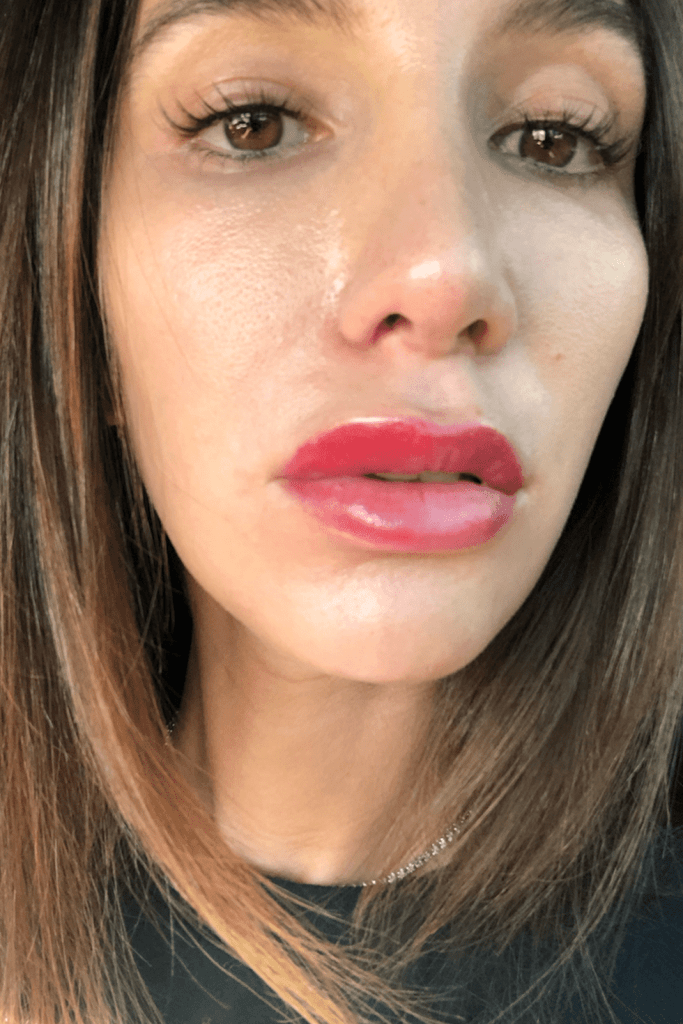 What is Lip Blushing allergic reaction