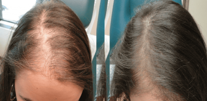 purc hair growth oil reviews 