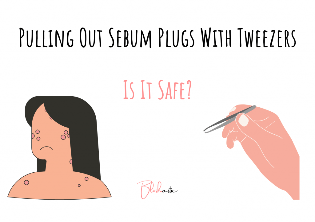 Pulling Out Sebum Plugs With Tweezers