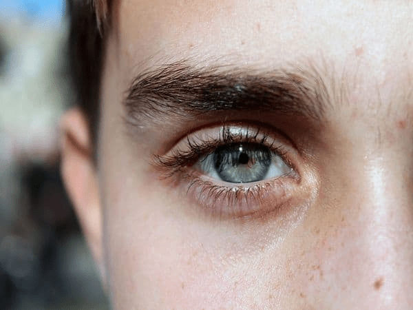 eyelash loss
