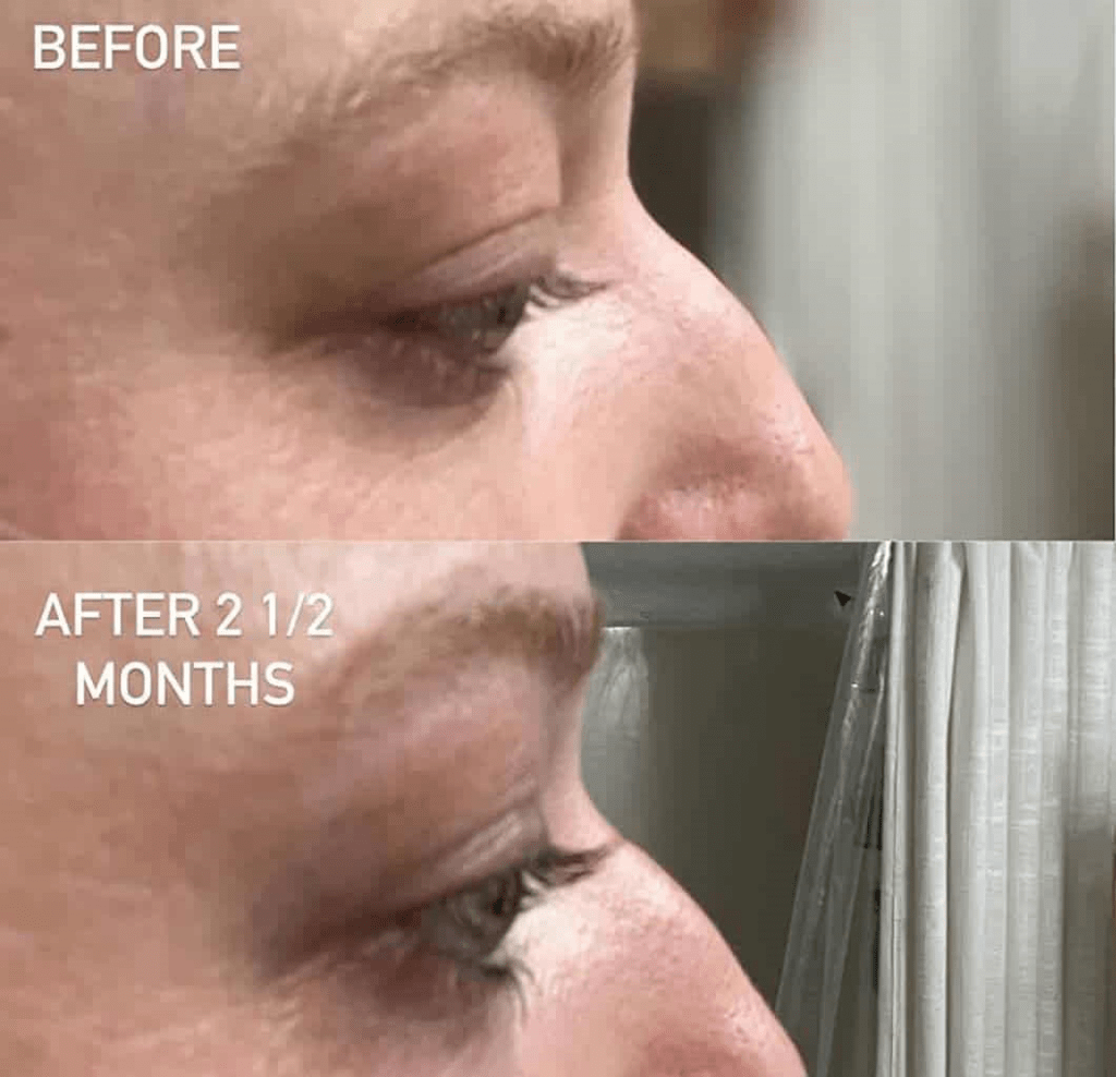 babe lash reviews before and after 