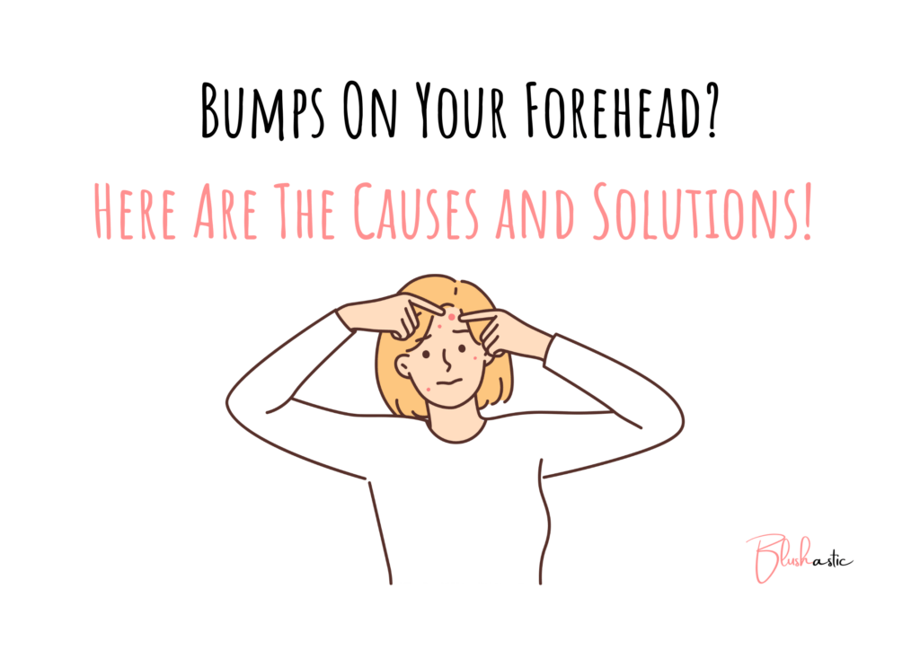 Bumps On Forehead Causes And Solutions Blushastic