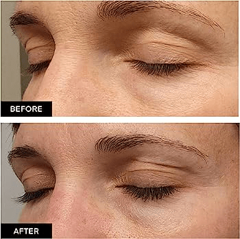 eyelash serum before and after 