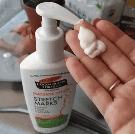 palmer's stretch mark lotion 