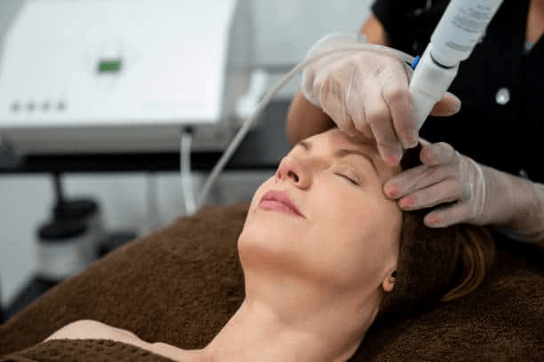 laser treatments 