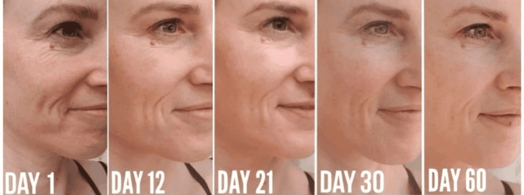 collagen before and after 