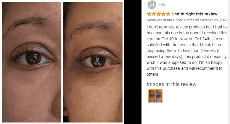 Drmtlgy Eye Masks before and after